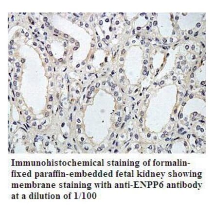 ENTPD1 Antibody from Signalway Antibody (39795) - Antibodies.com