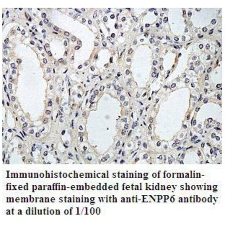 ENTPD1 Antibody from Signalway Antibody (39795) - Antibodies.com