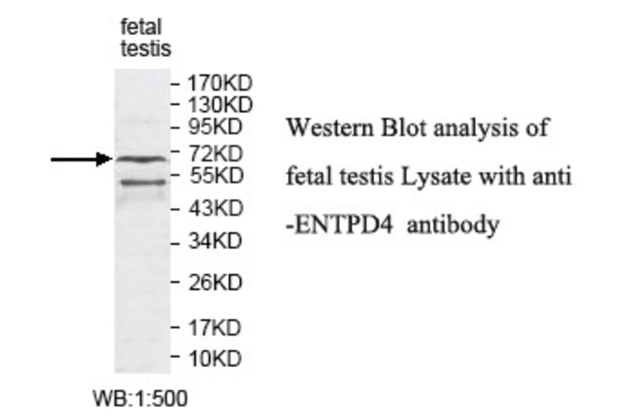 ENTPD1 Antibody from Signalway Antibody (39795) - Antibodies.com