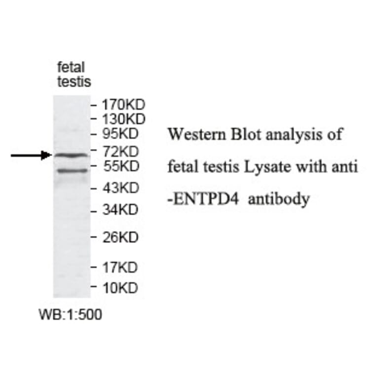 ENTPD1 Antibody from Signalway Antibody (39795) - Antibodies.com