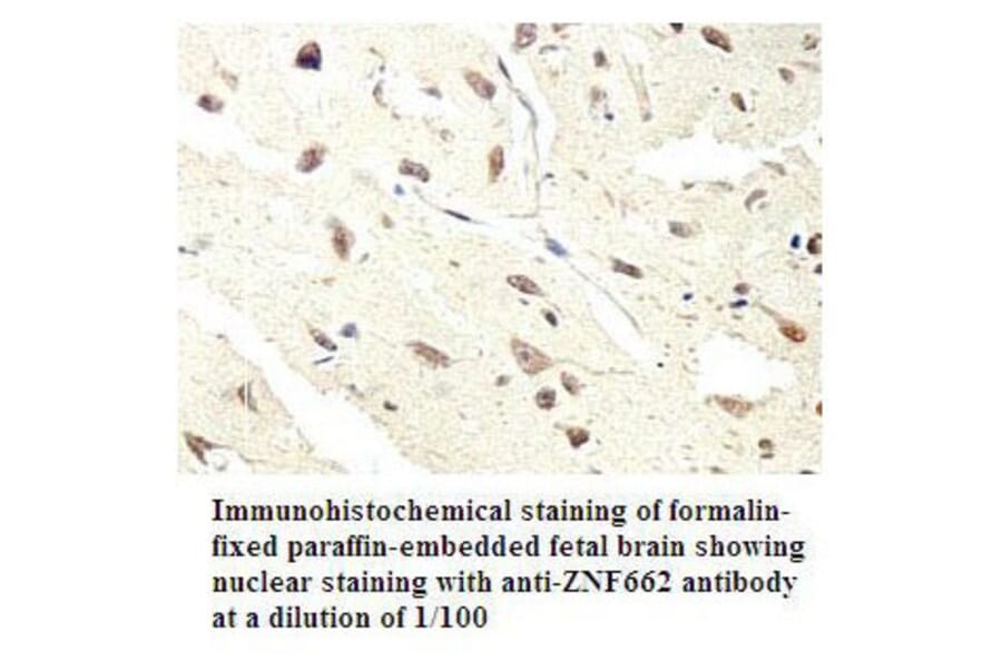 ZNF662 Antibody from Signalway Antibody (39796) - Antibodies.com