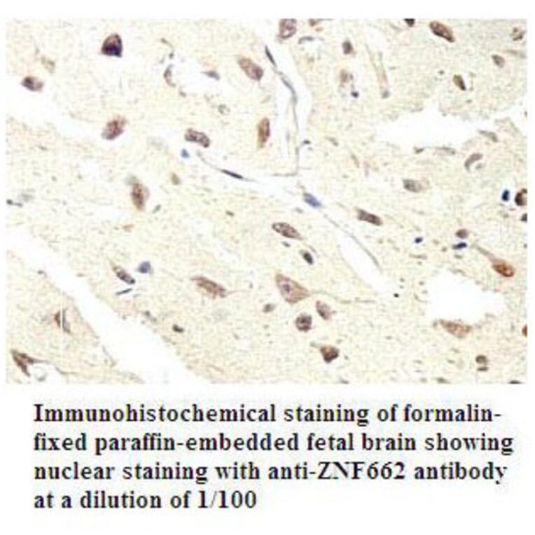 ZNF662 Antibody from Signalway Antibody (39796) - Antibodies.com