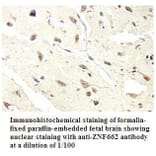 ZNF662 Antibody from Signalway Antibody (39796) - Antibodies.com