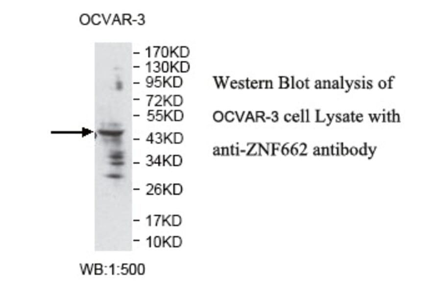 ZNF662 Antibody from Signalway Antibody (39796) - Antibodies.com