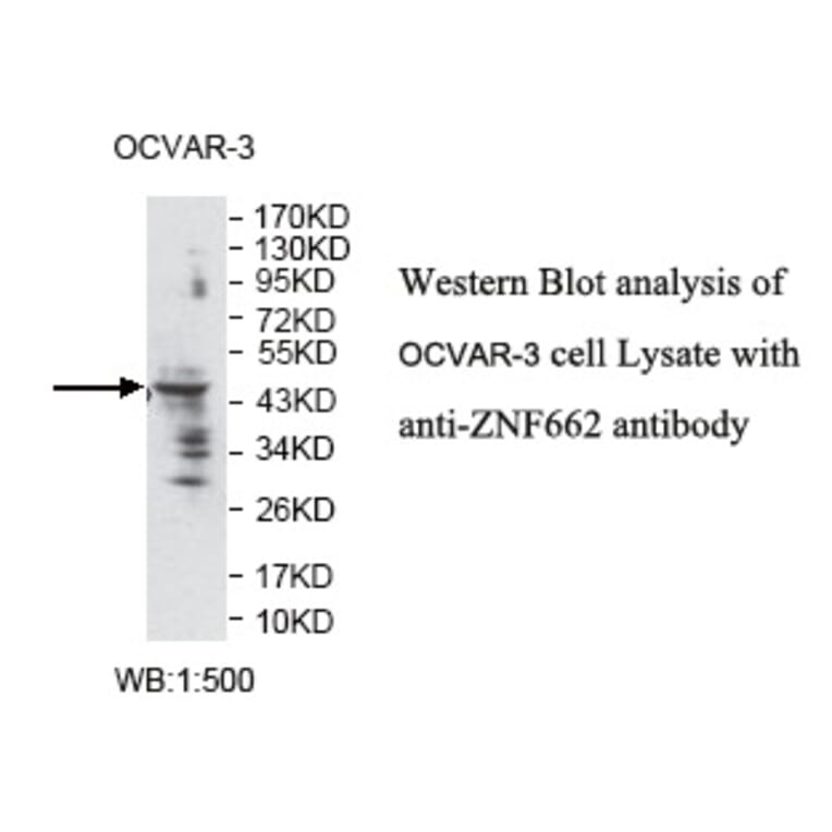 ZNF662 Antibody from Signalway Antibody (39796) - Antibodies.com