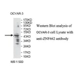 ZNF662 Antibody from Signalway Antibody (39796) - Antibodies.com