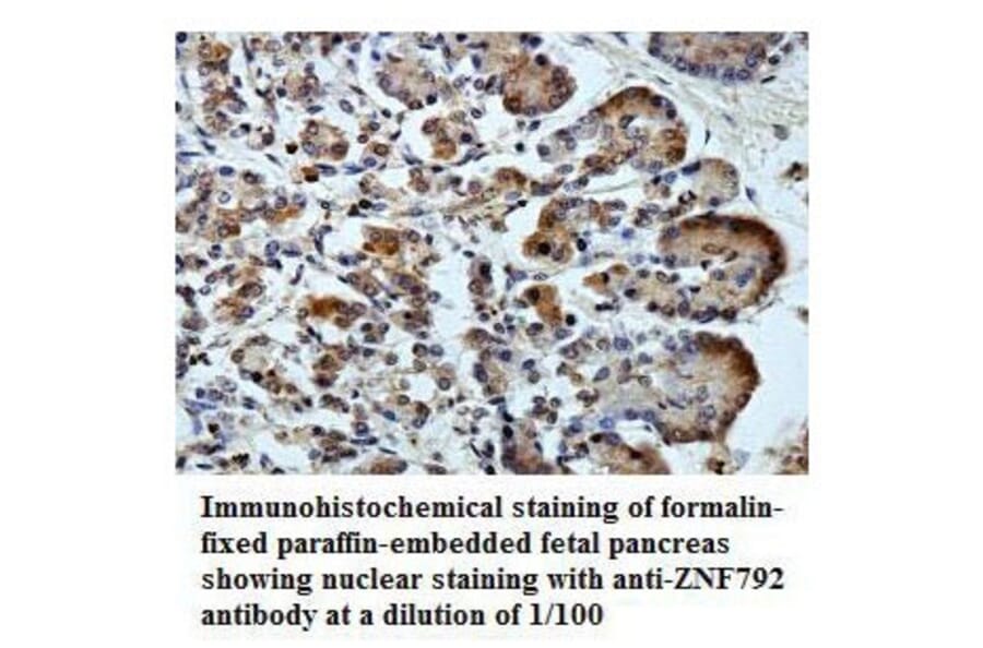 ZNF792 Antibody from Signalway Antibody (39798) - Antibodies.com
