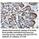 ZNF792 Antibody from Signalway Antibody (39798) - Antibodies.com