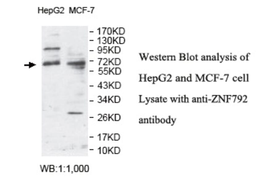 ZNF792 Antibody from Signalway Antibody (39798) - Antibodies.com