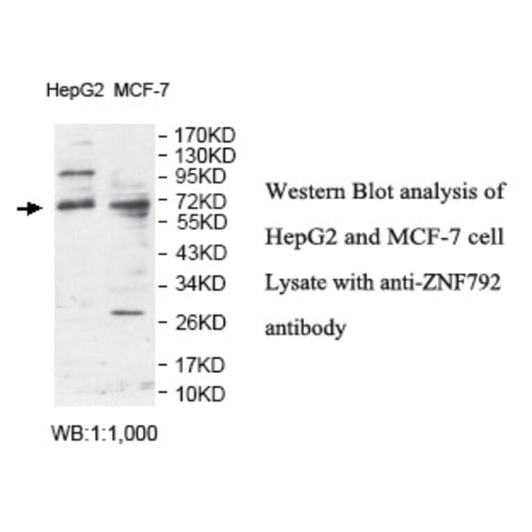ZNF792 Antibody from Signalway Antibody (39798) - Antibodies.com