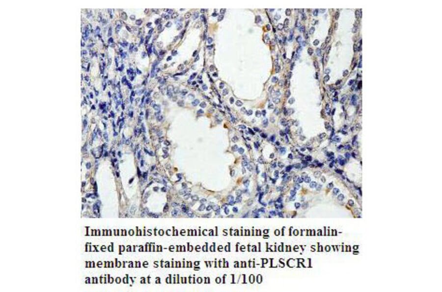 PLSCR1 Antibody from Signalway Antibody (39803) - Antibodies.com