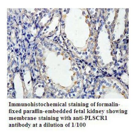 PLSCR1 Antibody from Signalway Antibody (39803) - Antibodies.com