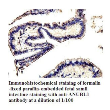 ANUBL1 Antibody from Signalway Antibody (39804) - Antibodies.com