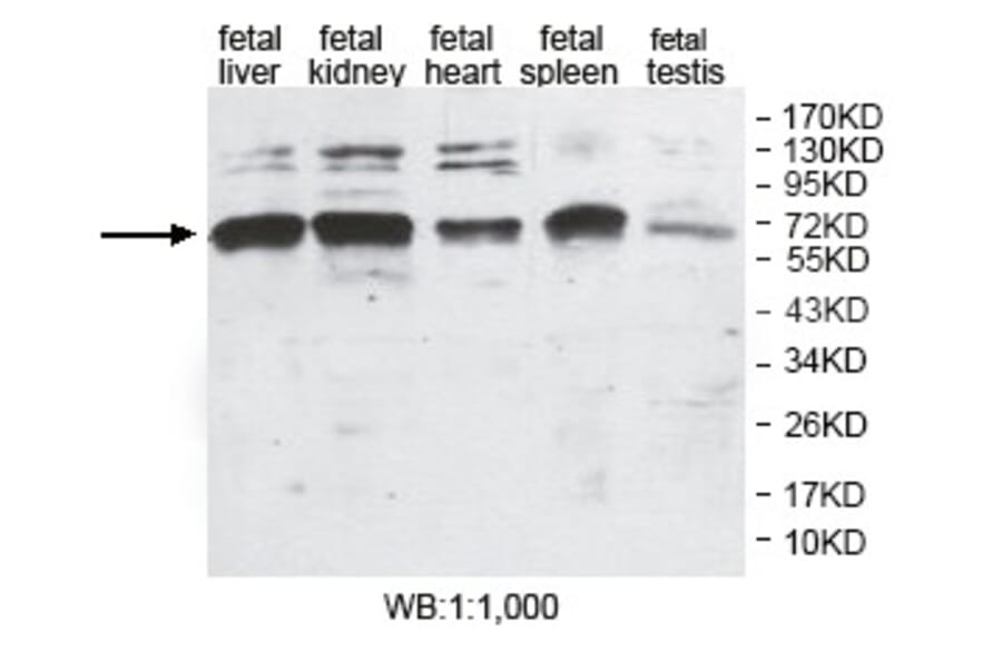 ANUBL1 Antibody from Signalway Antibody (39804) - Antibodies.com