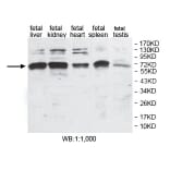 ANUBL1 Antibody from Signalway Antibody (39804) - Antibodies.com