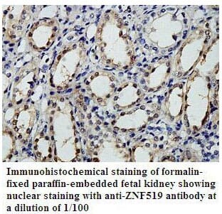 Anti-ZNF519 Antibody