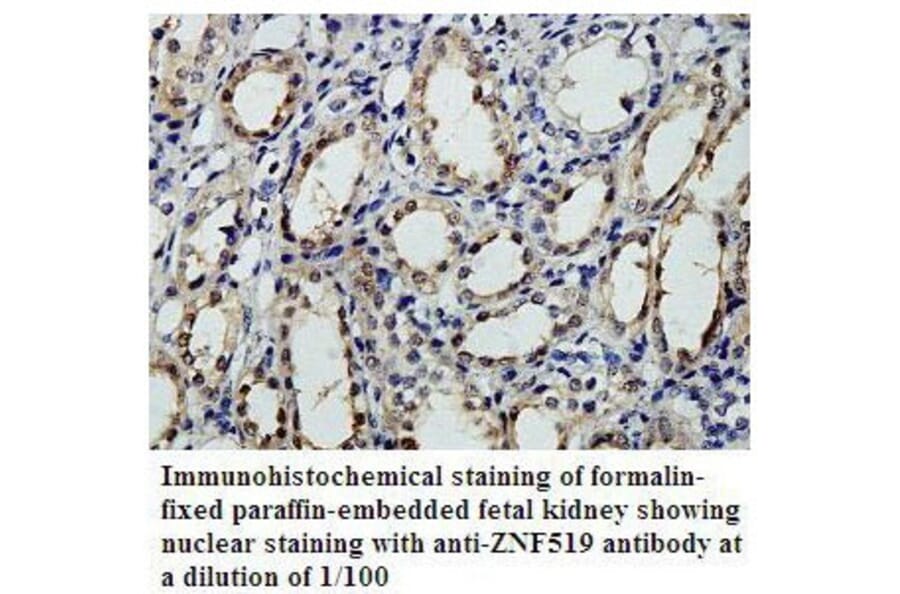 ZNF519 Antibody from Signalway Antibody (39805) - Antibodies.com