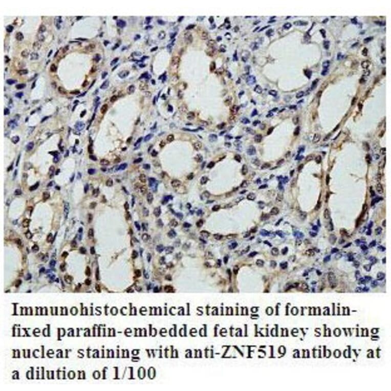 ZNF519 Antibody from Signalway Antibody (39805) - Antibodies.com