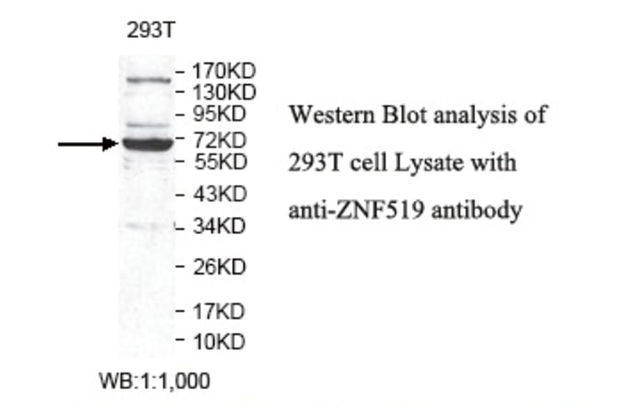 ZNF519 Antibody from Signalway Antibody (39805) - Antibodies.com
