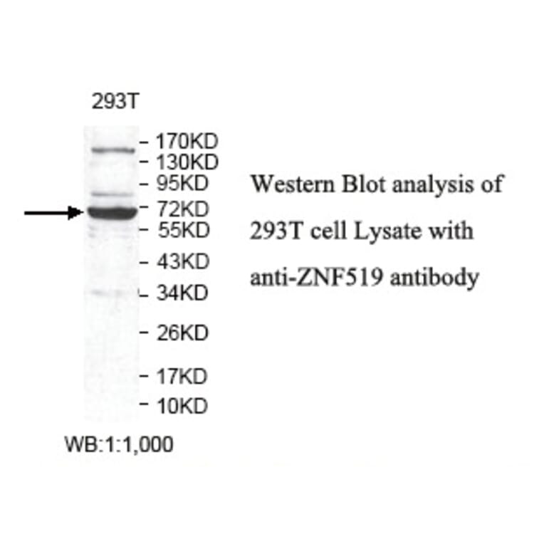 ZNF519 Antibody from Signalway Antibody (39805) - Antibodies.com