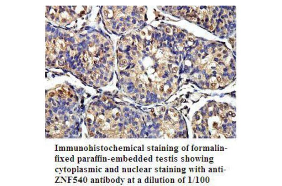 ZNF540 Antibody from Signalway Antibody (39806) - Antibodies.com