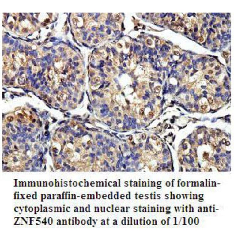 ZNF540 Antibody from Signalway Antibody (39806) - Antibodies.com