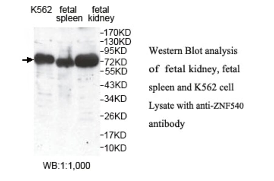 ZNF540 Antibody from Signalway Antibody (39806) - Antibodies.com