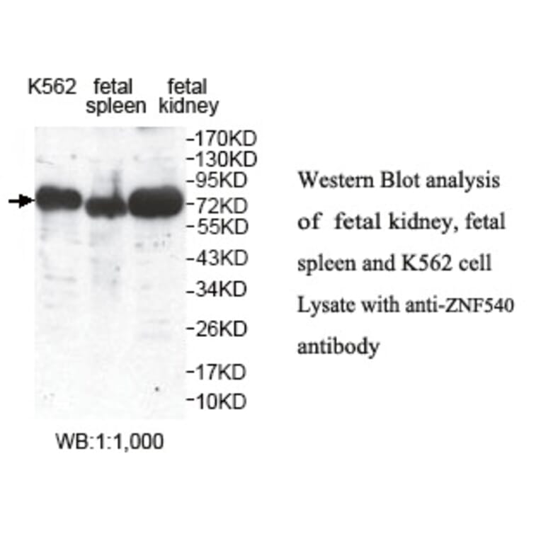 ZNF540 Antibody from Signalway Antibody (39806) - Antibodies.com