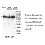 ZNF540 Antibody from Signalway Antibody (39806) - Antibodies.com