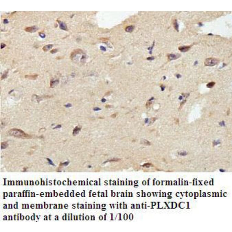 PLXDC1 Antibody from Signalway Antibody (39810) - Antibodies.com