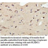 PLXDC1 Antibody from Signalway Antibody (39810) - Antibodies.com