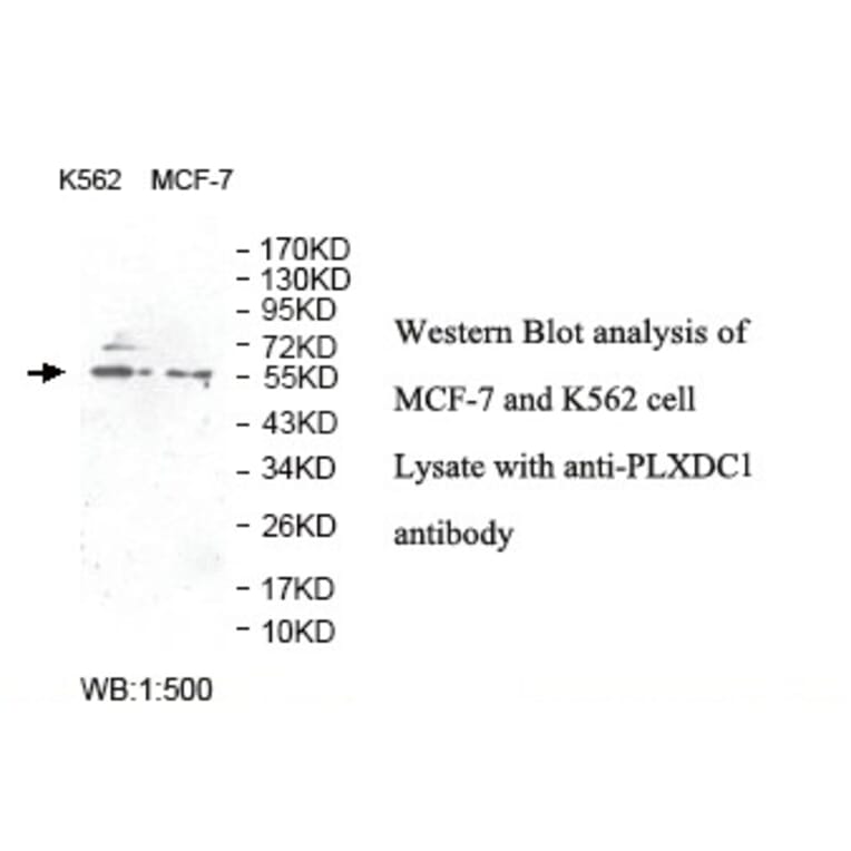 PLXDC1 Antibody from Signalway Antibody (39810) - Antibodies.com