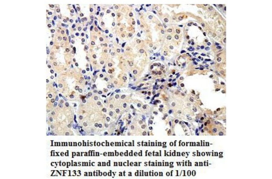 ZNF133 Antibody from Signalway Antibody (39815) - Antibodies.com