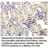 ZNF133 Antibody from Signalway Antibody (39815) - Antibodies.com