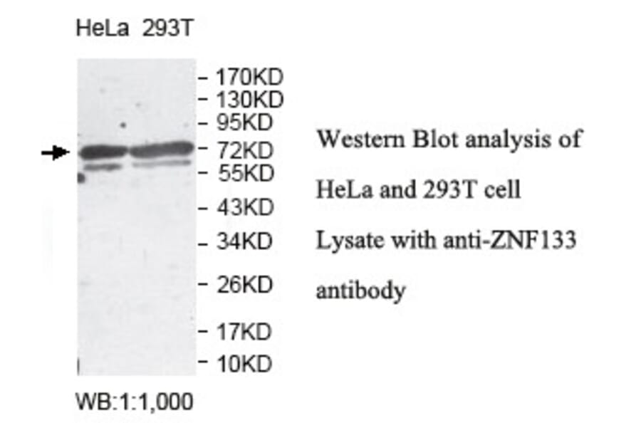 ZNF133 Antibody from Signalway Antibody (39815) - Antibodies.com