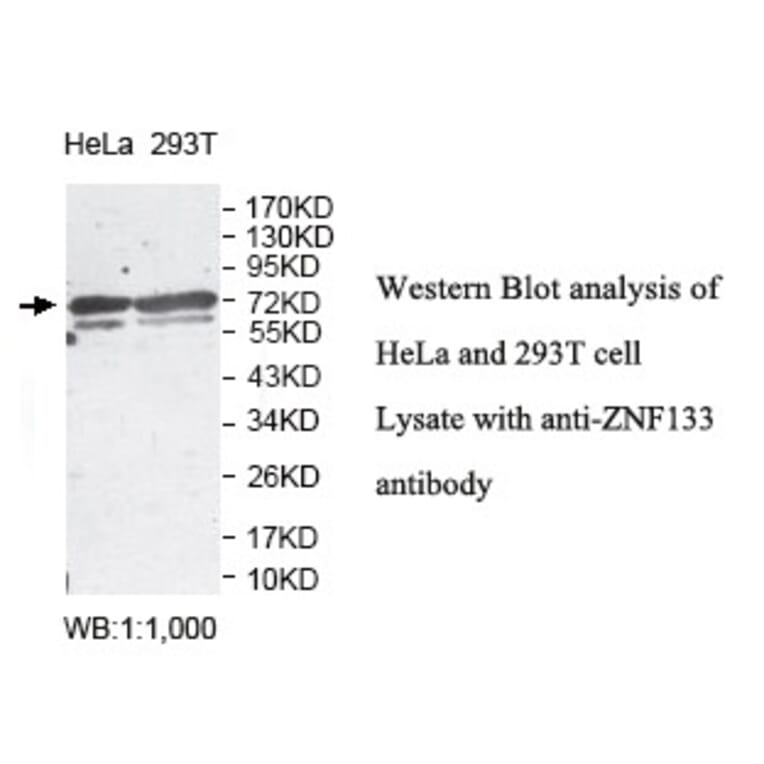 ZNF133 Antibody from Signalway Antibody (39815) - Antibodies.com