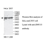 ZNF133 Antibody from Signalway Antibody (39815) - Antibodies.com