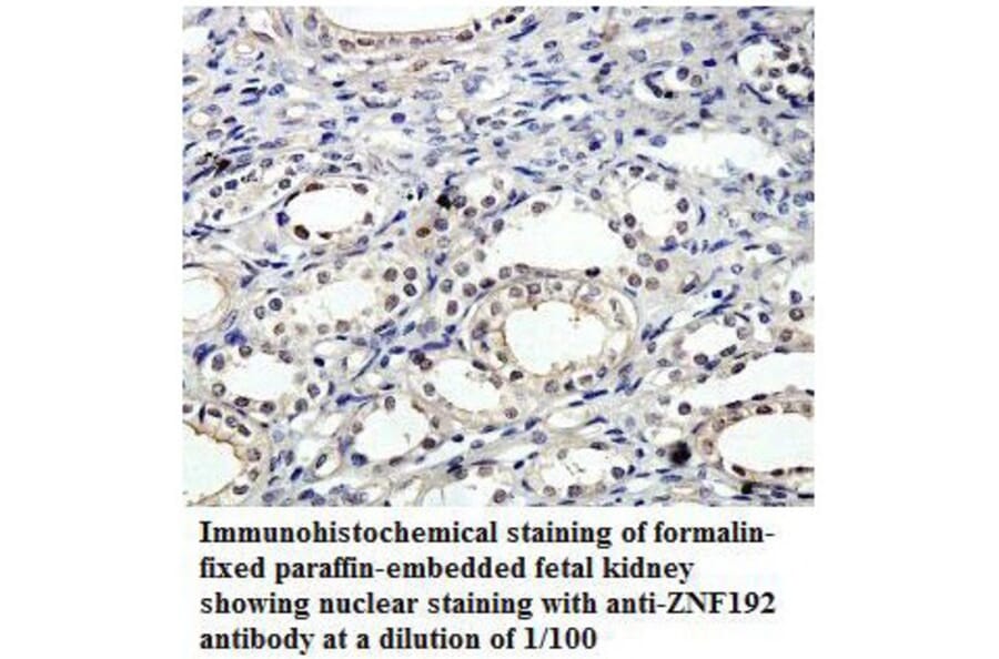 ZNF192 Antibody from Signalway Antibody (39816) - Antibodies.com