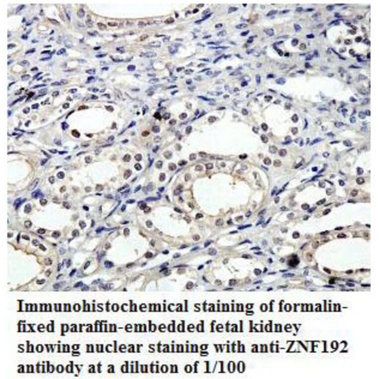 ZNF192 Antibody from Signalway Antibody (39816) - Antibodies.com