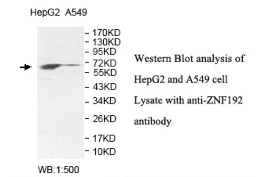 ZNF192 Antibody from Signalway Antibody (39816) - Antibodies.com