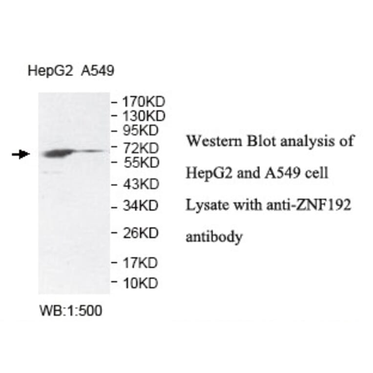 ZNF192 Antibody from Signalway Antibody (39816) - Antibodies.com