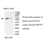 ZNF192 Antibody from Signalway Antibody (39816) - Antibodies.com