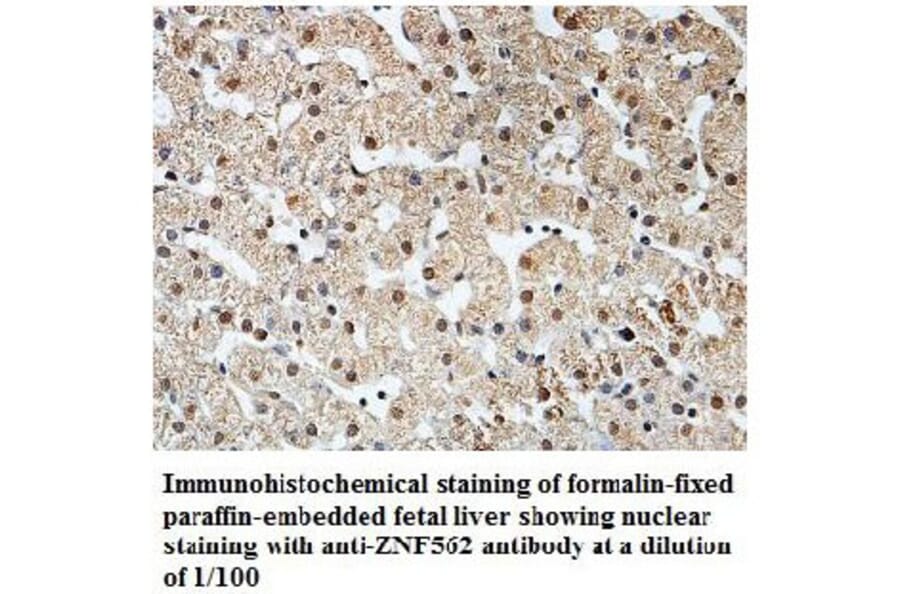 ZNF562 Antibody from Signalway Antibody (39817) - Antibodies.com