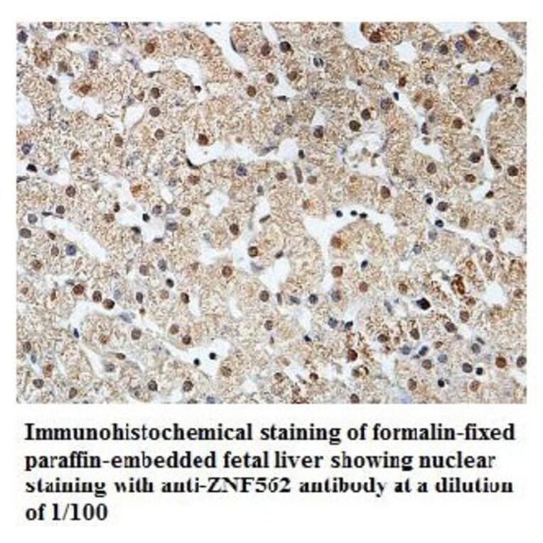 ZNF562 Antibody from Signalway Antibody (39817) - Antibodies.com