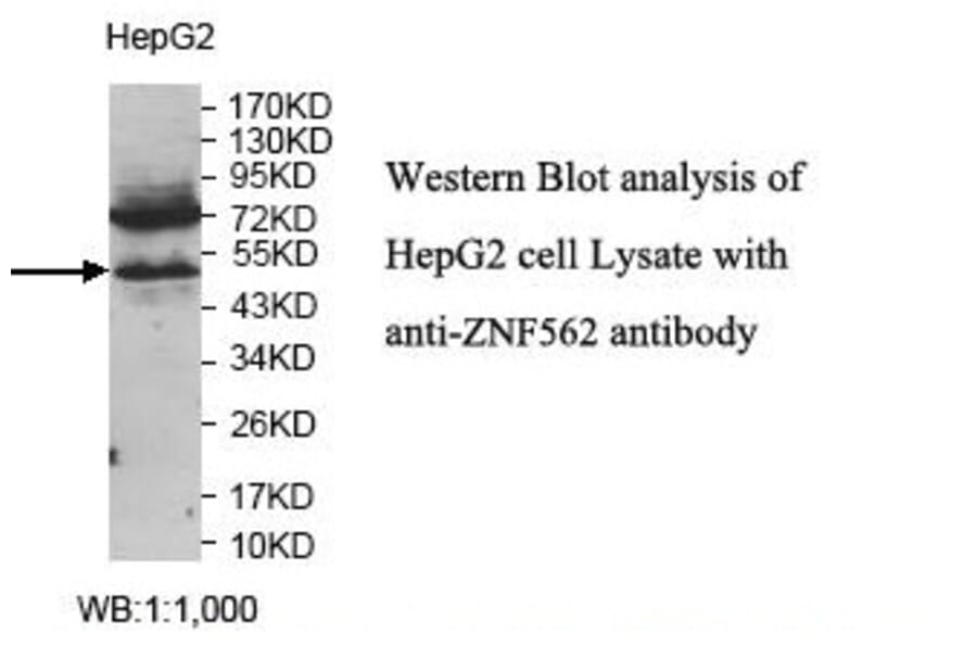 ZNF562 Antibody from Signalway Antibody (39817) - Antibodies.com