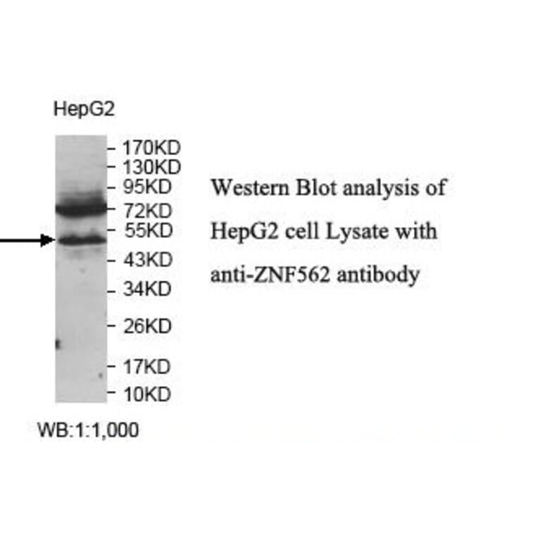 ZNF562 Antibody from Signalway Antibody (39817) - Antibodies.com