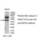 ZNF562 Antibody from Signalway Antibody (39817) - Antibodies.com