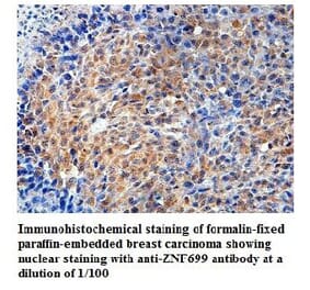ZNF699 Antibody from Signalway Antibody (39818) - Antibodies.com