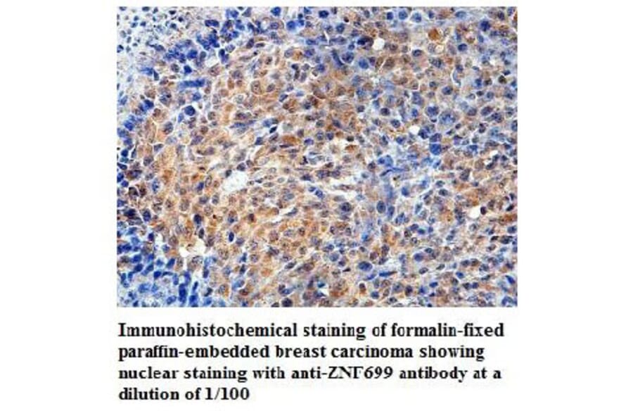 ZNF699 Antibody from Signalway Antibody (39818) - Antibodies.com