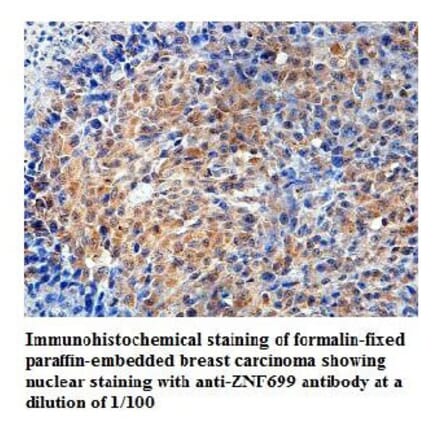 ZNF699 Antibody from Signalway Antibody (39818) - Antibodies.com